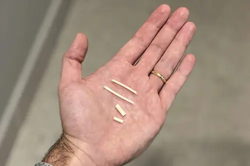 Imagem ilustrativa mostrando pequenos pedaços de material, possivelmente representando o implante hormonal, com detalhes visíveis em uma mão humana.